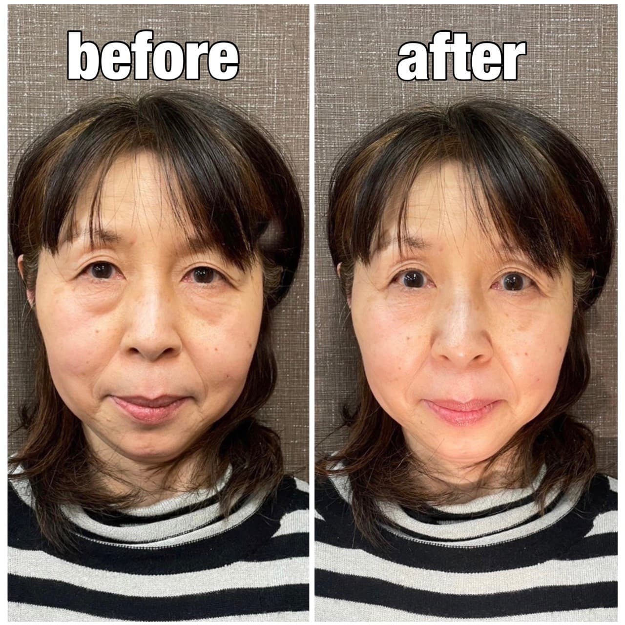 肌ツヤも良くなり、目もハッキリと!