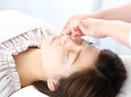 顔に鍼を打っている写真